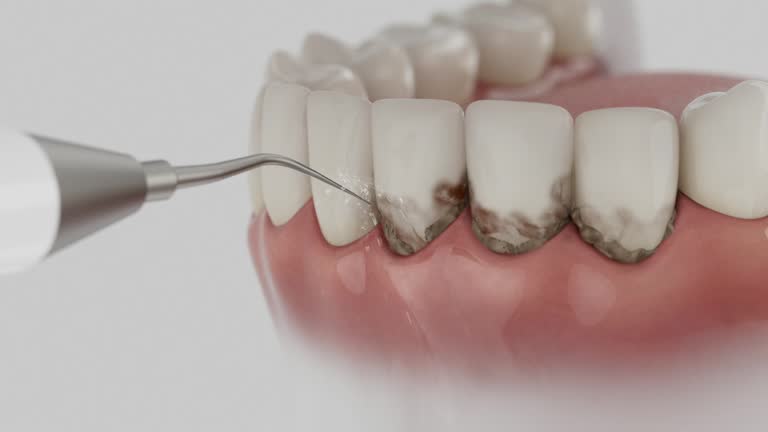 Trusted Dental Implants service in Apache, OK - Dentist Open Now